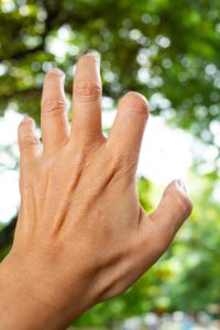 Trigger Finger Arlington VA