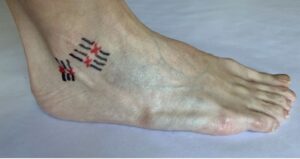 Close-up of foot and ankle