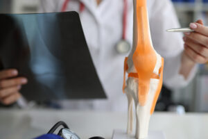 Orthopedic specialist using model of knee joint to point out signs of rheumatoid arthritis