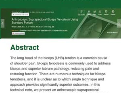 Dr. Paik recently published a technique article in the Arthroscopy Technique Journal on a novel arthroscopic biceps tenodesis technique requiring fewer incisions